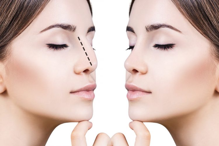 rhinoplasty-nose-surgery-nose-job
